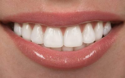 achieve-the-perfect-smile-with-dental-veneers-scaled-1-768x512-1